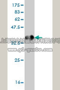 merck millipore,默克密理博,ST1611,Anti-HPSE Mouse mAb (4D7)