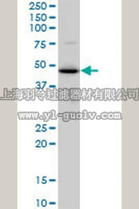 merck millipore,默克密理博,ST1613,Anti-TXNDC4 Mouse mAb (3C7)