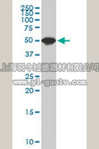 merck millipore,默克密理博,ST1617,Anti-SPG3A Mouse mAb (1B9)