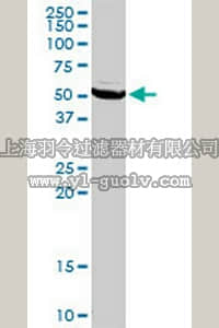 merck millipore,默克密理博,ST1635,Anti-ECGF1 Rabbit pAb