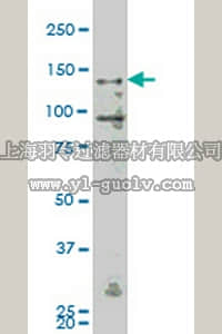 merck millipore,默克密理博,ST1641,Anti-MAP4K4 Mouse mAb (4A5)