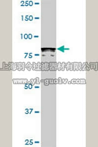 merck millipore,默克密理博,ST1650,Anti-DYRK1A Mouse mAb (7D10)