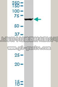 merck millipore,默克密理博,ST1651,Anti-GRK6 Mouse mAb (2C3)