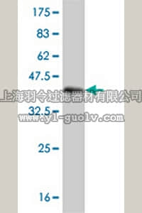 merck millipore,默克密理博,ST1660,Anti-MSLN Mouse mAb (1A10)