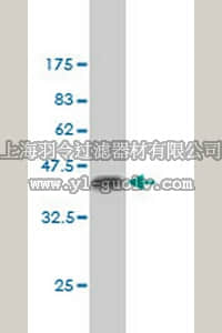 merck millipore,默克密理博,ST1662,Anti-BCL9 Mouse mAb (2D4)