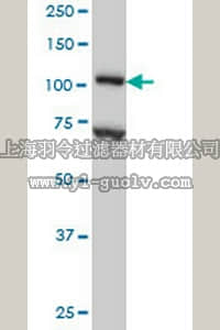 merck millipore,默克密理博,ST1672,Anti-DPYD Mouse mAb (7D4)