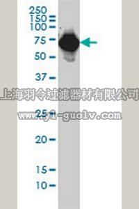 merck millipore,默克密理博,ST1673,Anti-AFP Mouse mAb (1G7)