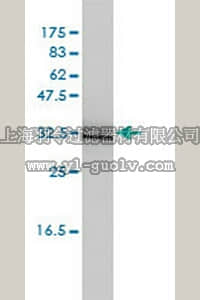 merck millipore,默克密理博,ST1681,Anti-SIGIRR Mouse mAb (3H8-2G3)