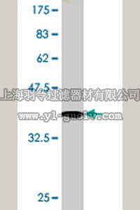 merck millipore,默克密理博,ST1685,Anti-TRPA1 Mouse mAb (6G8)