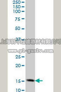 merck millipore,默克密理博,ST1705,Anti-TOMM20 Mouse mAb (4F3)