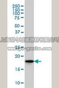 merck millipore,默克密理博,ST1709,Anti-SKP1A Mouse mAb (1H8)