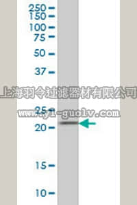 merck millipore,默克密理博,ST1711,Anti-DFHR Mouse mAb (2B10)