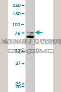 merck millipore,默克密理博,ST1718,Anti-SMO Mouse mAb (1D9)