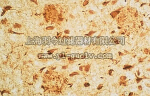 merck millipore,默克密理博,AB1518,Anti-Neurofibrillary Tangles Antibody