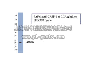 merck millipore,默克密理博,AB15254,Anti-Calcitonin Receptor-Stimulating Peptide-1 Antibody