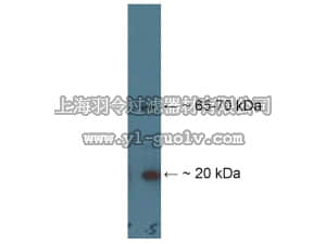 merck millipore,默克密理博,AB15255,Anti-AIGP1 Antibody