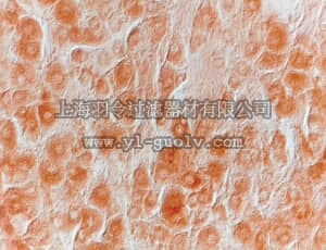 merck millipore,默克密理博,AB1526P,Anti-Nerve Growth Factor-β Antibody, pain