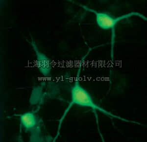merck millipore,默克密理博,AB1550,Anti-Calretinin Antibody
