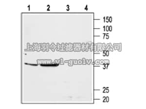 merck millipore,默克密理博,AB15552-200UL,Anti-AT1 Receptor Antibody