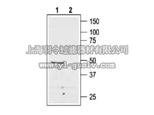 merck millipore,默克密理博,AB15554-200UL,Anti-AT2 Receptor Antibody
