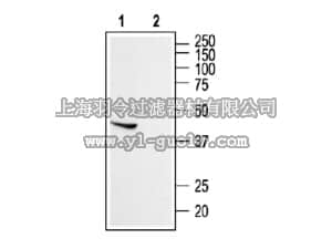 merck millipore,默克密理博,AB15556-50UL,Anti-Somatostatin Receptor Type 5 Antibody