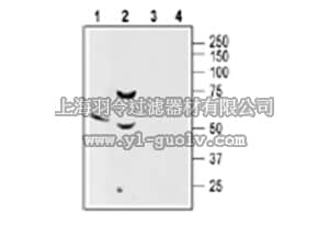 merck millipore,默克密理博,AB15558-50UL,Anti-Somatostatin Receptor Type 2 Antibody
