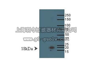 merck millipore,默克密理博,AB15640,Anti-LMO4 Antibody