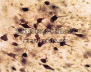 merck millipore,默克密理博,AB1582,Anti-Choline Acetyltransferase Antibody