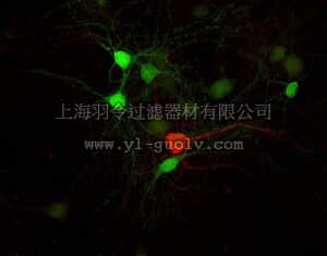 merck millipore,默克密理博,MAB318,Anti-Tyrosine Hydroxylase Antibody, clone LNC1