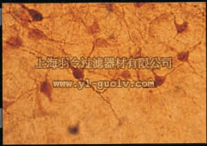 merck millipore,默克密理博,AB176,Anti-Adenosine Deaminase Antibody