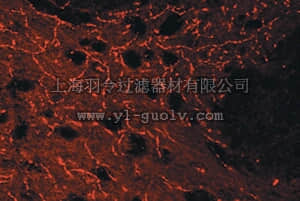 merck millipore,默克密理博,AB1772,Anti-Serotonin Transporter Antibody