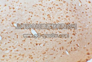 merck millipore,默克密理博,AB1779SP,Anti-Brain Derived Neurotrophic Factor Antibody
