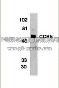 merck millipore,默克密理博,AB1889,Anti-C-C Chemokine Receptor 5 Antibody, NT