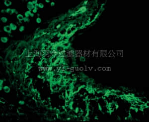 merck millipore,默克密理博,AB19013,Anti-Tenascin Antibody