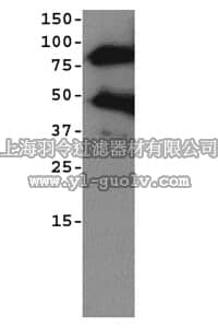 merck millipore,默克密理博,AB19017,Anti-ADAM 8 Antibody, cytoplasmic domain