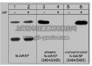 merck millipore,默克密理博,AB1964,Anti-N-WASP Antibody, phospho-specific [Ser484/Ser485]
