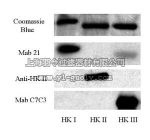 merck millipore,默克密理博,AB3279,Anti-Hexokinase Type II Antibody