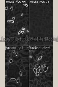 merck millipore,默克密理博,AB3553,Anti-Thiazide-Sensitive NaCl Cotransporter Antibody