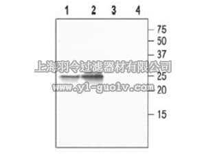 merck millipore,默克密理博,AB3559-50UL,Anti-Aquaporin 5 Antibody