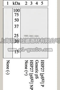 merck millipore,默克密理博,AB3561,Anti-phospho HSP27 (pS82) Antibody