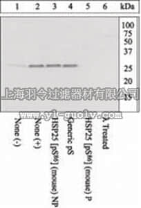 merck millipore,默克密理博,AB3563,Anti-phospho mouse HSP25 (pS86) Antibody