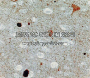 merck millipore,默克密理博,AB5038P,Anti-Synuclein α Antibody