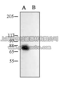 merck millipore,默克密理博,AB5174,Anti-Potassium Channel Kv1.1 Antibody