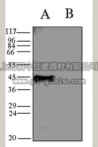 merck millipore,默克密理博,AB5200-200UL,Anti-Potassium Channel GIRK2 Antibody