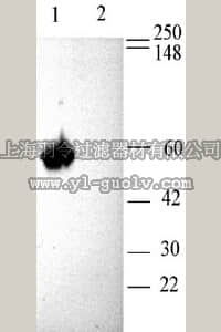 merck millipore,默克密理博,AB5230-200UL,Anti-Calcium Channel Antibody, Voltage Gated β3