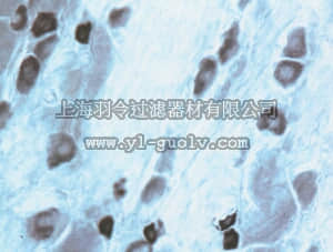 merck millipore,默克密理博,AB5370,Anti-Capsaicin Receptor Antibody, CT