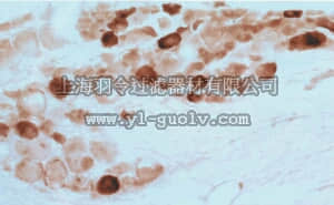 merck millipore,默克密理博,AB5398,Anti-Vanilloid Receptor Like Protein 1 Antibody, pain, CT