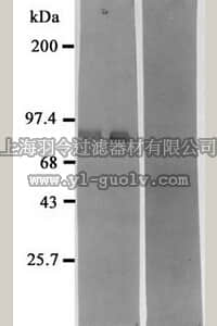 merck millipore,默克密理博,AB5458,Anti-Neprilysin Antibody (Neutral Endopeptidase, Nep)