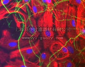 merck millipore,默克密理博,AB5539,Anti-Neurofilament H Antibody