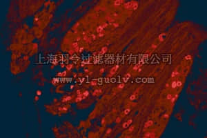 merck millipore,默克密理博,AB5566,Anti-Capsaicin Receptor Antibody, CT